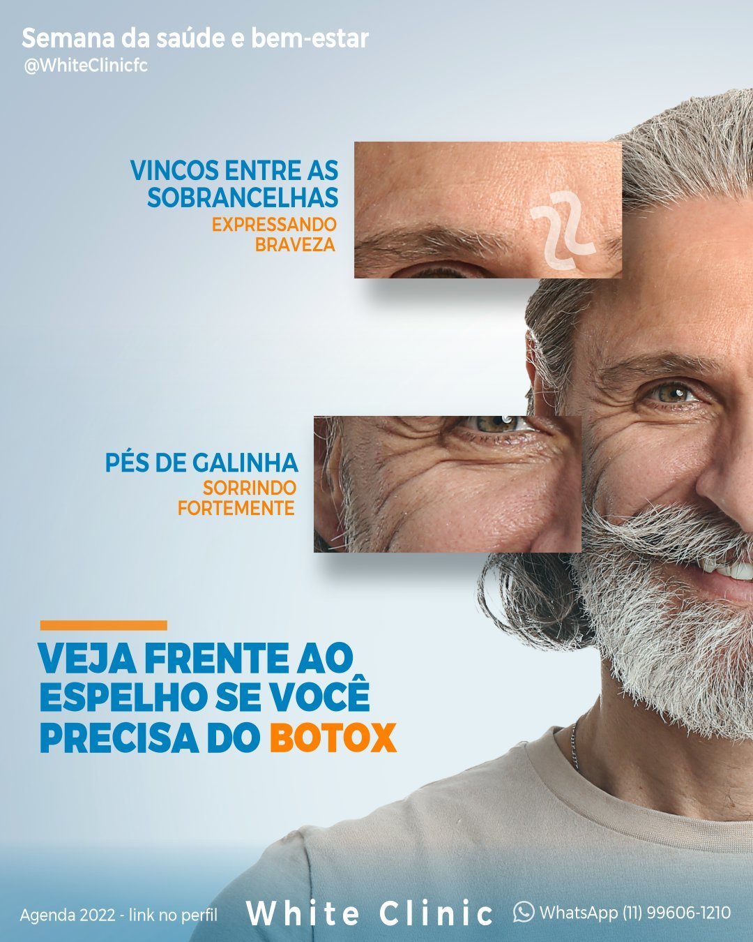 Veja-frente-ao-espelho-se-voce-precisa-do-botox1.jpg